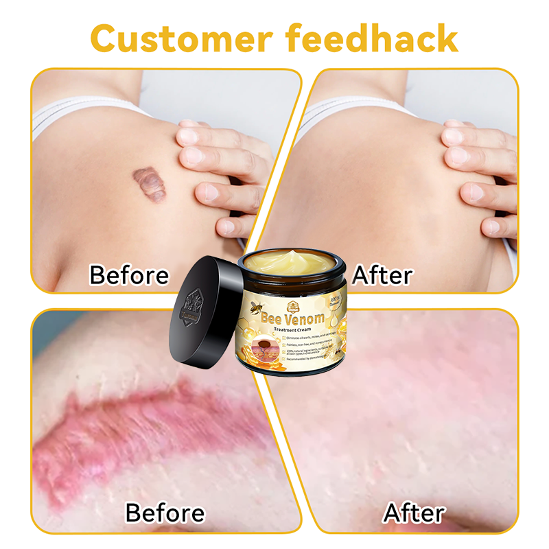 𝑇𝑢𝑟𝑜𝑛𝑢™ Bee Venom Skin Treatment Cream💧