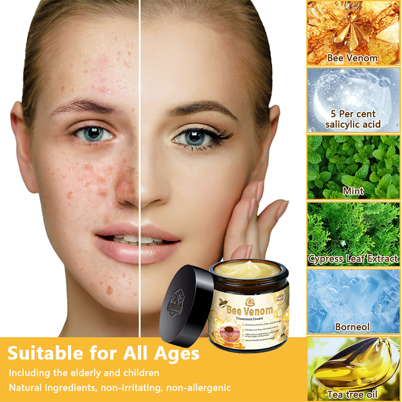 𝑇𝑢𝑟𝑜𝑛𝑢™ Bee Venom Skin Treatment Cream💧