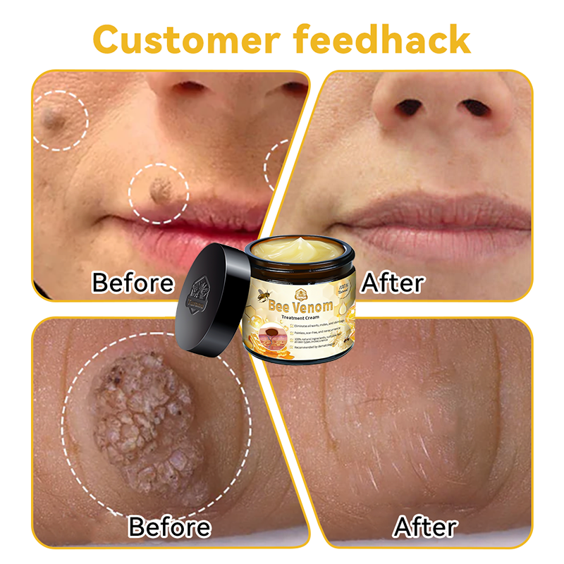 𝑇𝑢𝑟𝑜𝑛𝑢™ Bee Venom Skin Treatment Cream💧