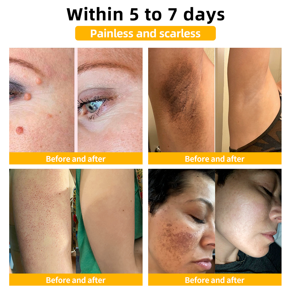 𝑇𝑢𝑟𝑜𝑛𝑢™ Bee Venom Skin Treatment Cream💧