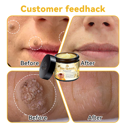 𝑇𝑢𝑟𝑜𝑛𝑢™ Bee Venom Skin Treatment Cream💧